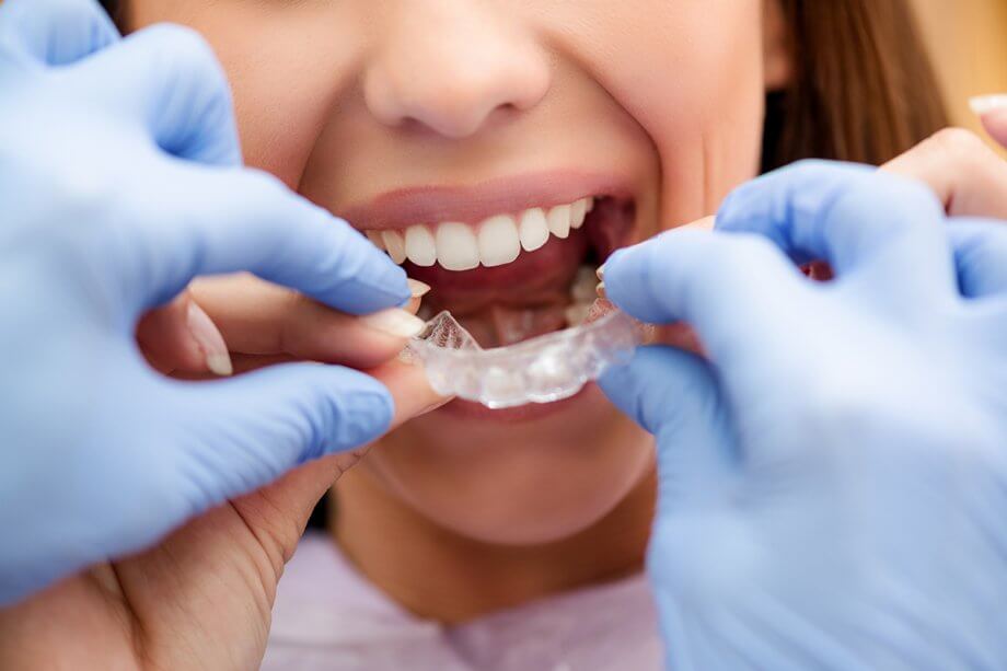 Pros and Cons of Using Invisalign to Straighten Your Teeth